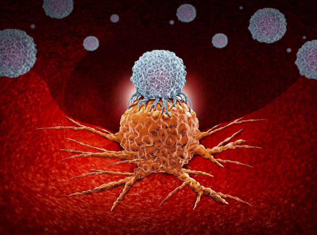 Immunotherapy: 'Killer' cells get boost in fight against cancer