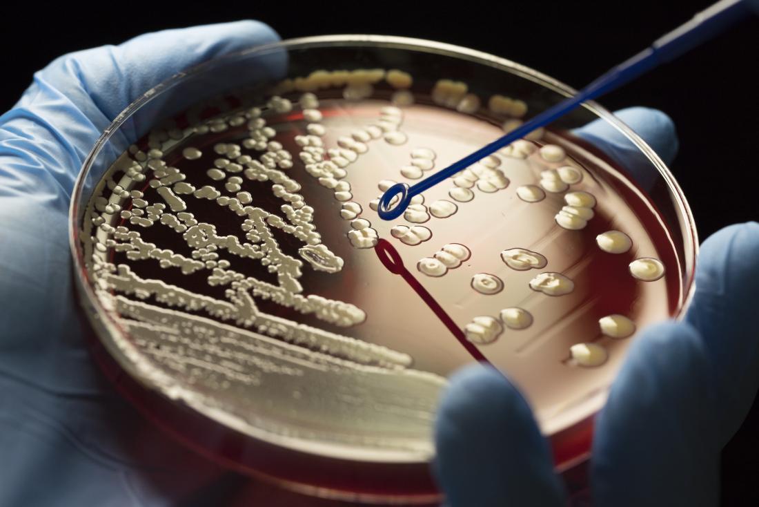 The rise of superbugs: Facing the antibiotic resistance crisis