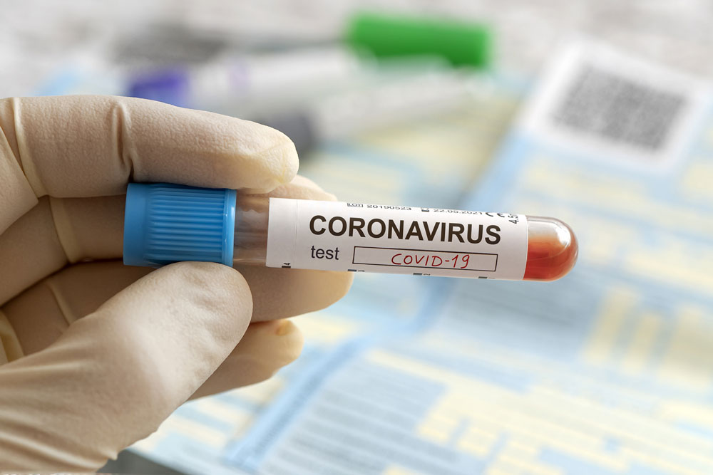 Coronavirus: Govt fears 50,000 cases and 1,000 deaths by May