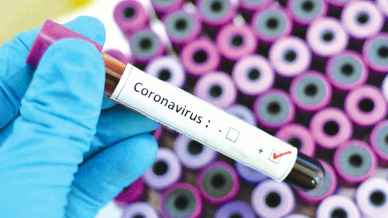 Coronavirus: Expatriate tests positive after death in Chattogram