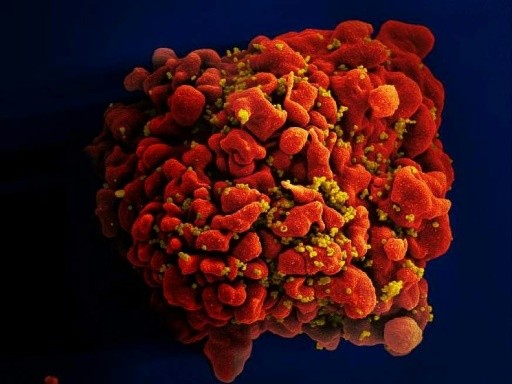 Four decades on, where's the HIV vaccine?