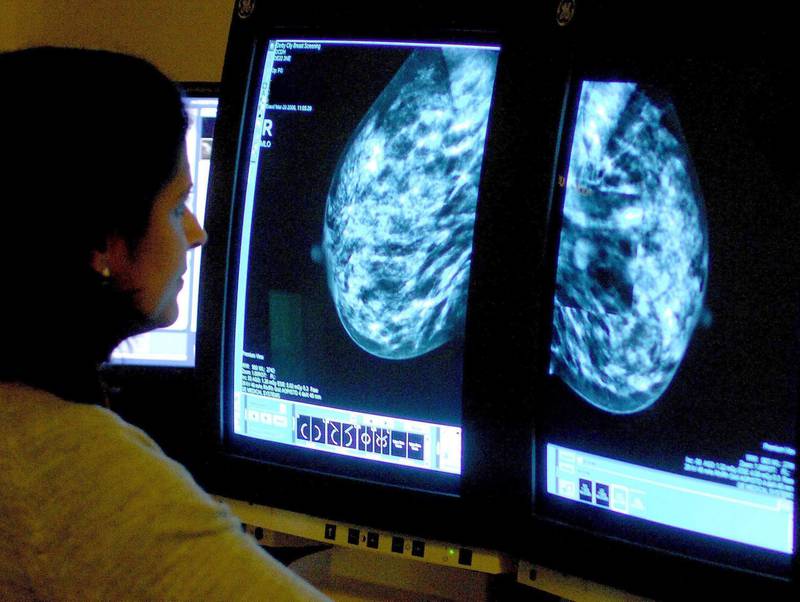 Have cancer check-ups often even if you have no symptoms, expert says