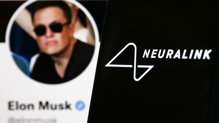 Musk approaches brain chip startup Synchron about deal amid Neuralink delays, sources say