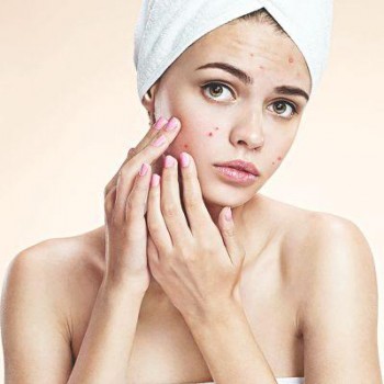 Personalise your acne treatment