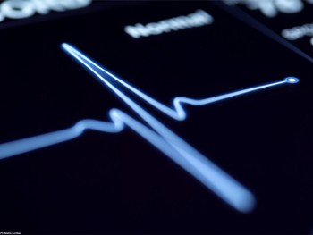 Artificial Intelligence outshines doctors at predicting heart disease deaths