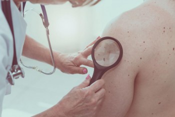 Existing antibiotic could help treat melanoma