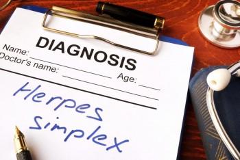 Herpes may account for 50 percent of Alzheimer's cases