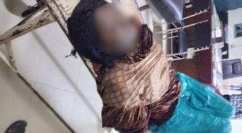 Rajshahi College girl set on fire dies at DMCH
