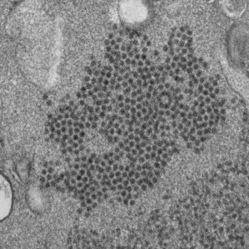 Study points to virus as culprit in kids' paralyzing illness