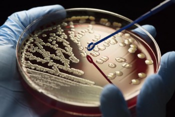The rise of superbugs: Facing the antibiotic resistance crisis