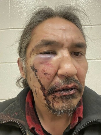 Canada indigenous chief battered during arrest