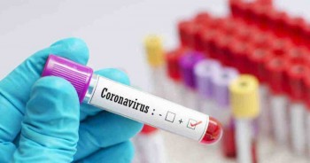 Coronavirus global caseload now 31,779,533