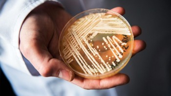 COVID-19 may promote the spread of drug-resistant ‘superfungus’