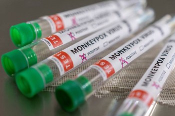 First clinical trials of monkeypox treatment Tpoxx start in UK