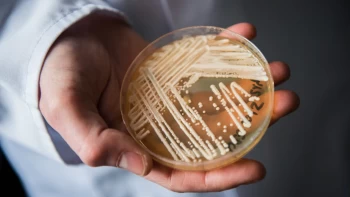An emerging fungal threat spread at an alarming rate in US health care facilities, study says